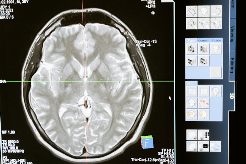 AI-powered medical diagnostic system analysing patient data for early disease detection